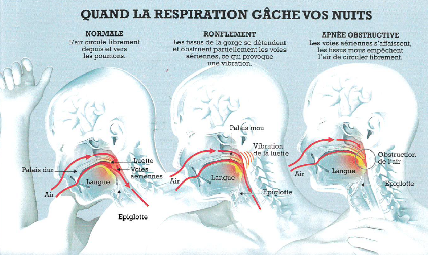 Image de l'actualité